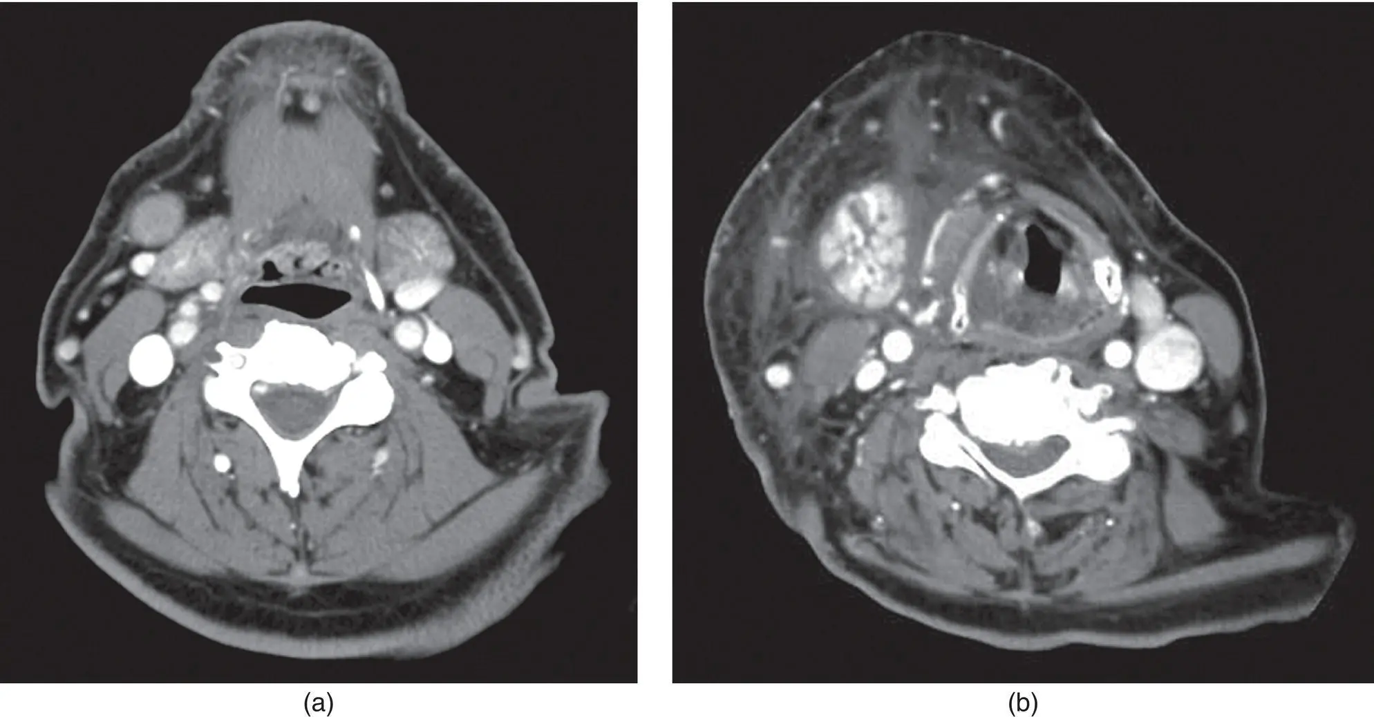 Figure 313 The CT scan a of a 73yearold man with a oneyear history of - фото 127