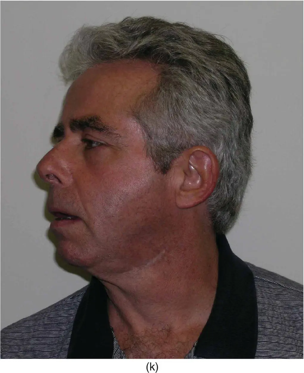 Figure 315 A 52yearold man a with a oneyear history of vague discomfort - фото 131