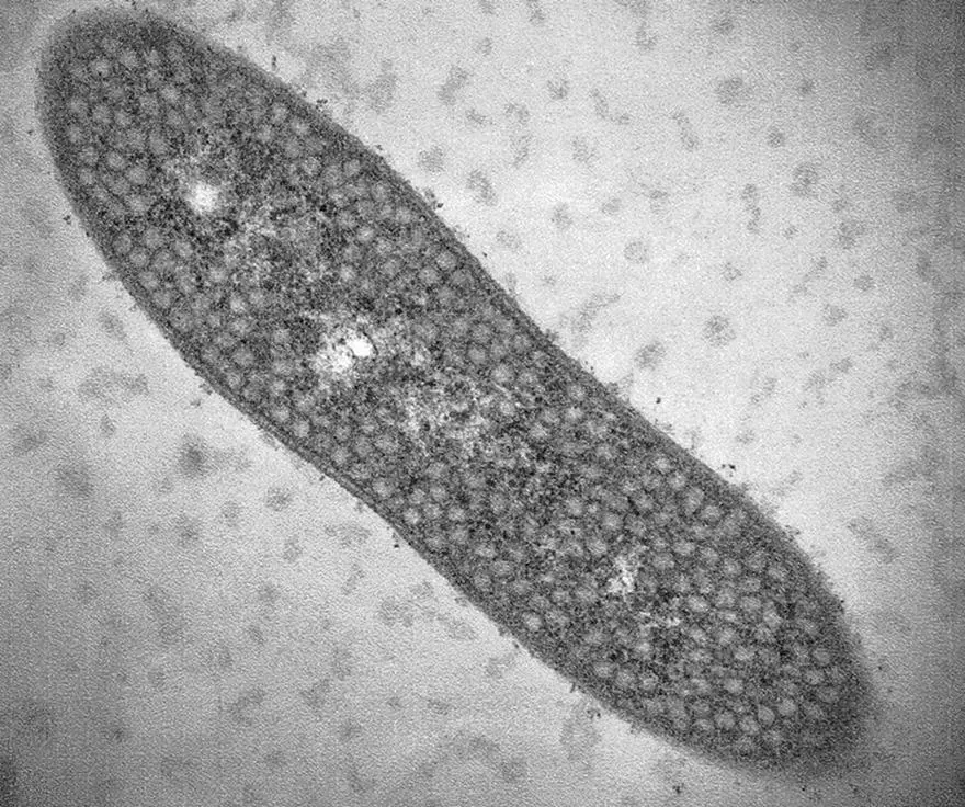 Figure 23 Thin section transmission electron micrograph of the purple - фото 10