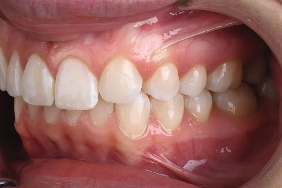 Figure 310 Retracted left photograph displaying left side of teeth The left - фото 13