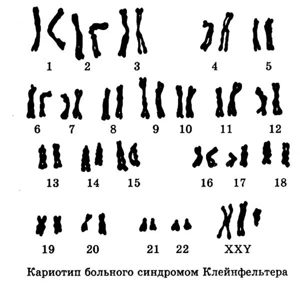 В клетках таких девочек не достает одной Xхромосомы т е их полный кариотип - фото 141
