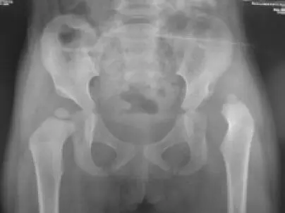 En los niños mayores de 6 años el tratamiento es complejo - фото 108