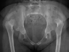 Diagnóstico por imágenes Las imágenes diagnósticas son el complemento para una - фото 97