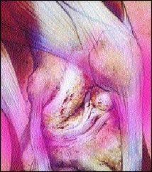 Автор Неизвестен - Береги суставы!