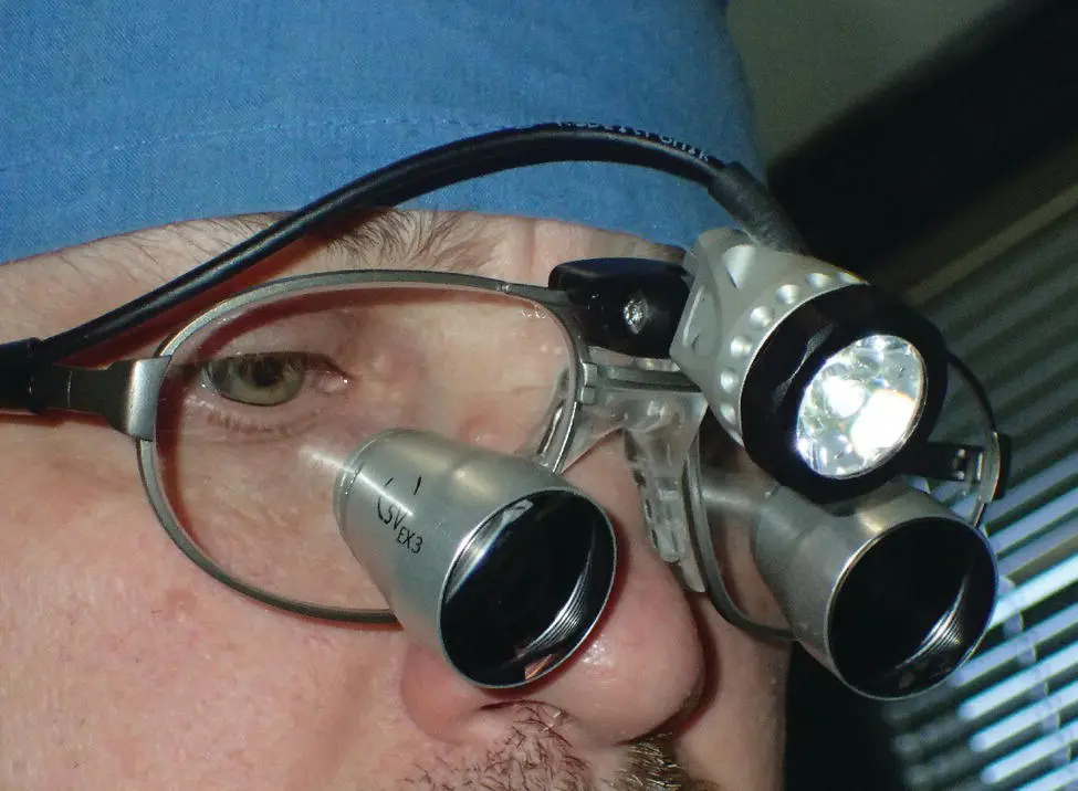Figure 126 Magnification helps greatly with dental procedures Figure 127 - фото 30