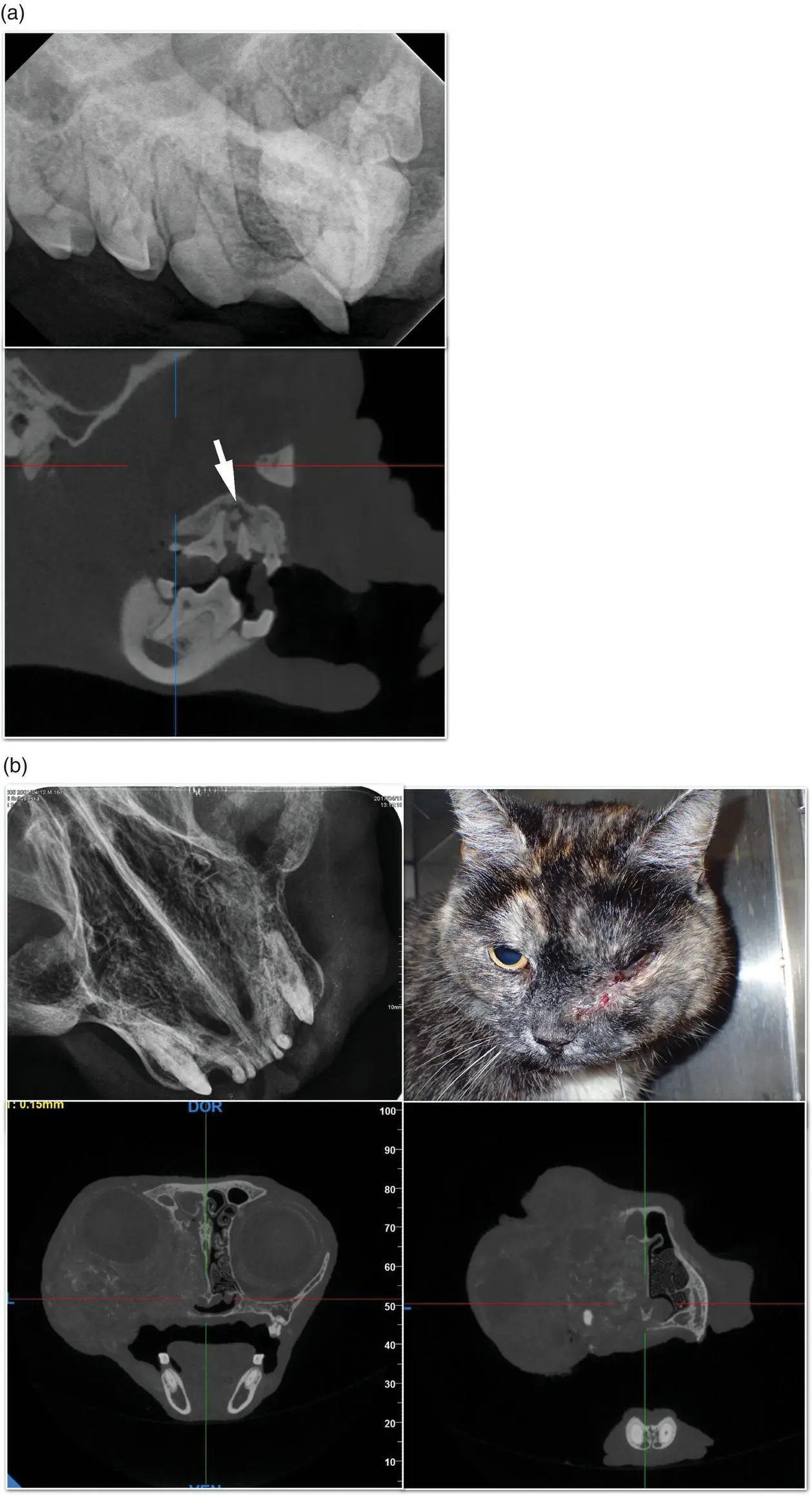 Figure 119 Advantages of 3D versus 2D imaging a The sequestrum revealed - фото 23