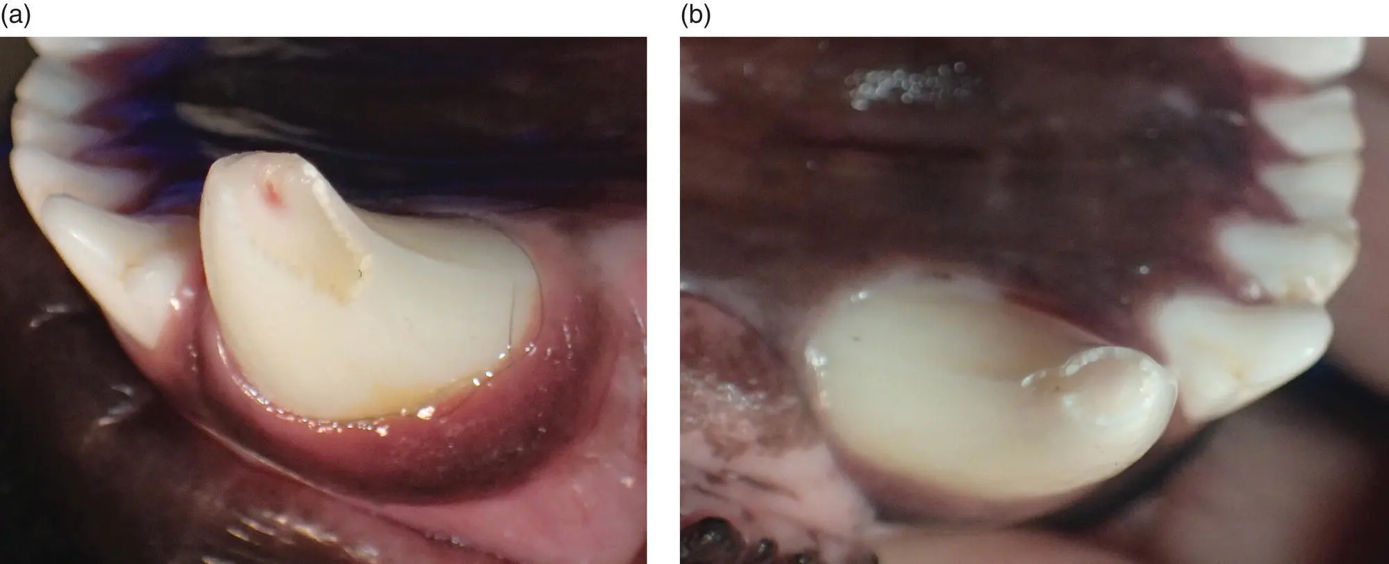Figure 43 a This patient came to boarding with a fractured 304 b An - фото 54