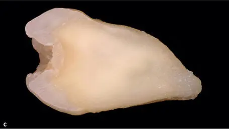 Fig 123a to 123c Crosssections of anterior and posterior teeth displaying - фото 81