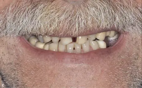 Figs 145a to 145c Initial situation of the patient portrait smile line - фото 196
