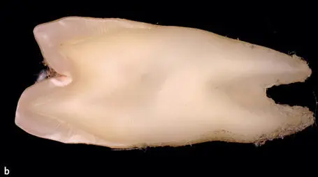 Fig 123a to 123c Crosssections of anterior and posterior teeth displaying - фото 80