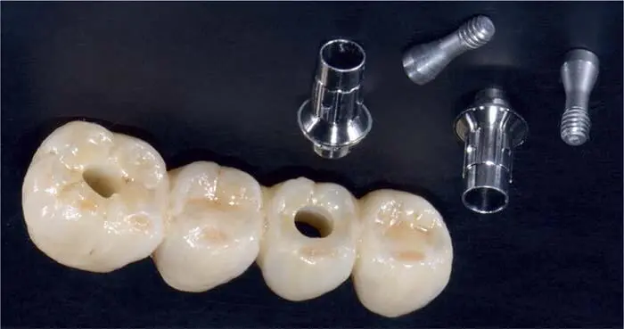 Fig 139e Final occlusal view of the direct screwretained monolithic - фото 181
