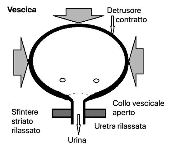 Fig 3 Fase minzionale Quando la vescica raggiunge la sua capacità - фото 3