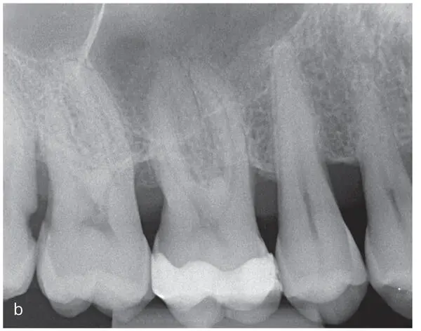 Innovations in Preventive Dentistry - фото 46