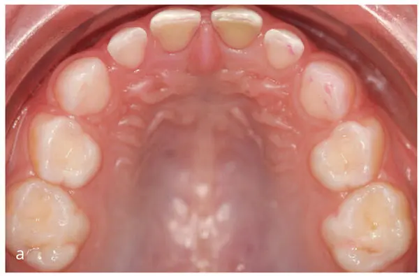 Innovations in Preventive Dentistry - фото 7