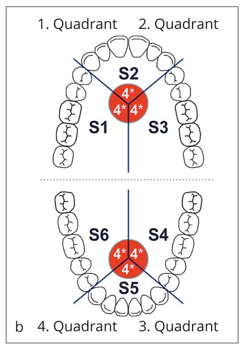 Figs 22a to cPeriodontal Screening Index PSI a Periodontal conditions are - фото 22