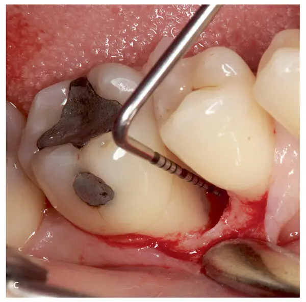 Figs 27a to eRepresentative images of the corrective therap - фото 38
