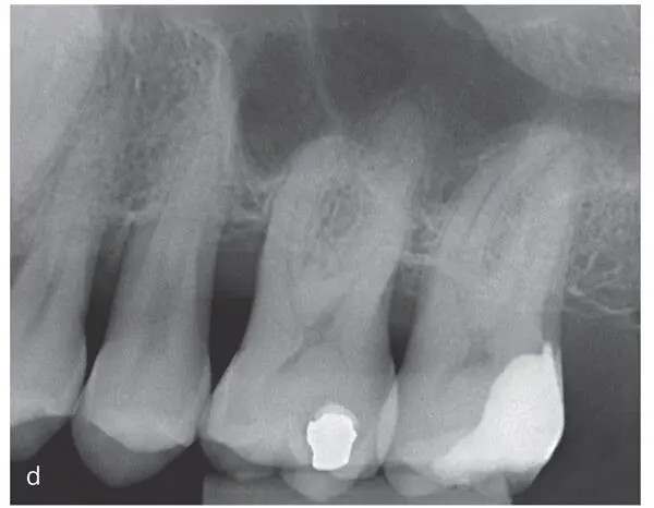 Figs 29a to fRadiographic images of the therapeutic outcome - фото 48