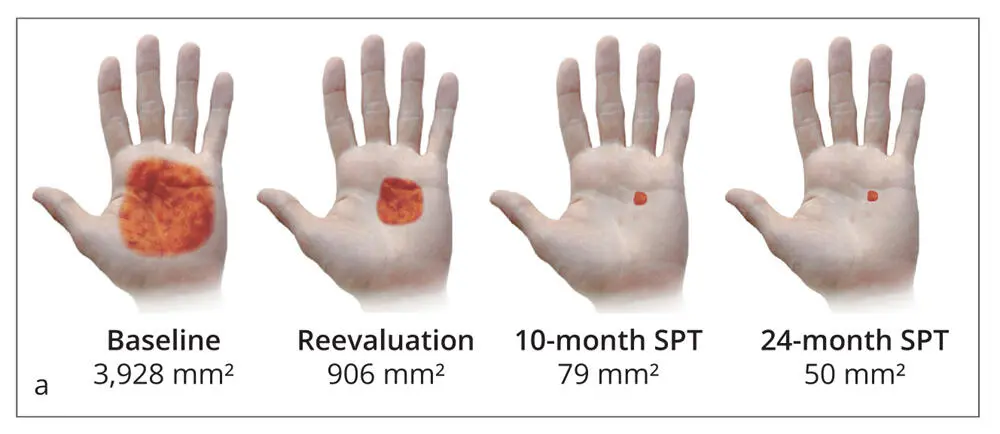 Innovations in Preventive Dentistry - фото 41