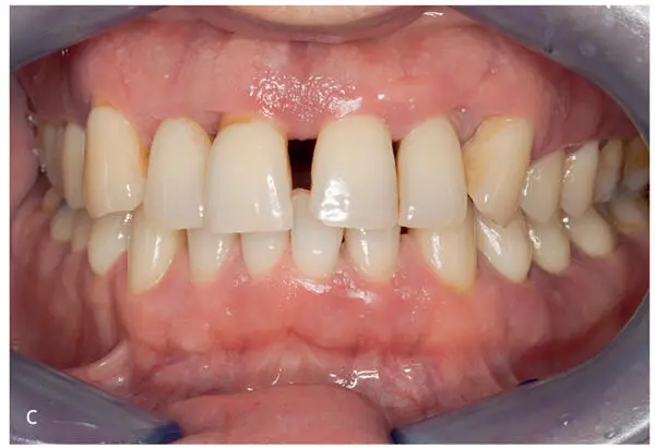 Innovations in Preventive Dentistry - фото 29