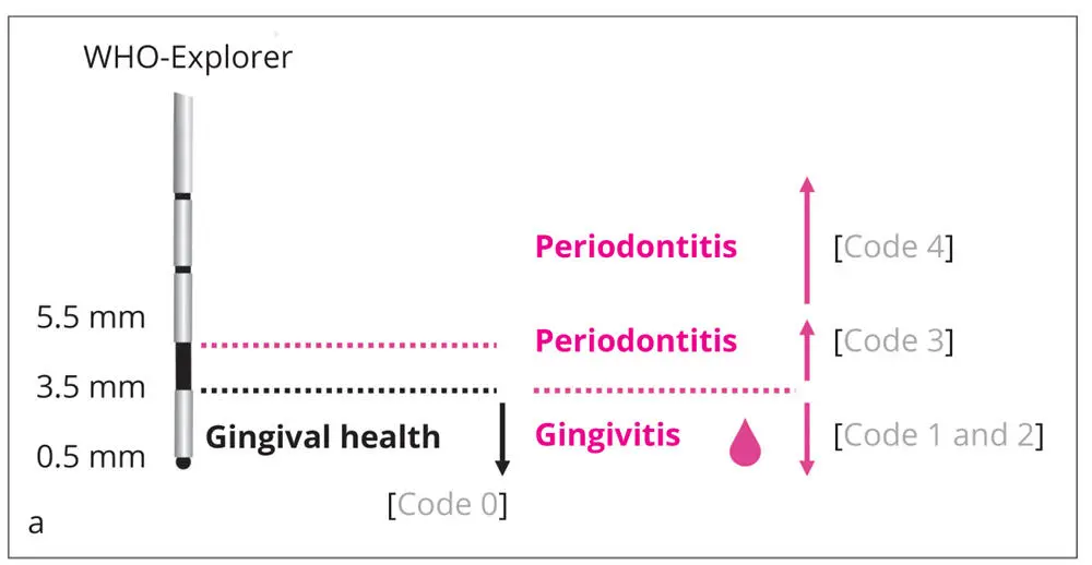 Figs 22a to cPeriodontal Screening Index PSI a Periodo - фото 21
