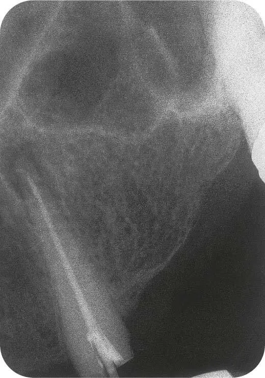 Abb 7Zahn 23 im Röntgenbild nach endodontischer Versorgung Das weitere - фото 138