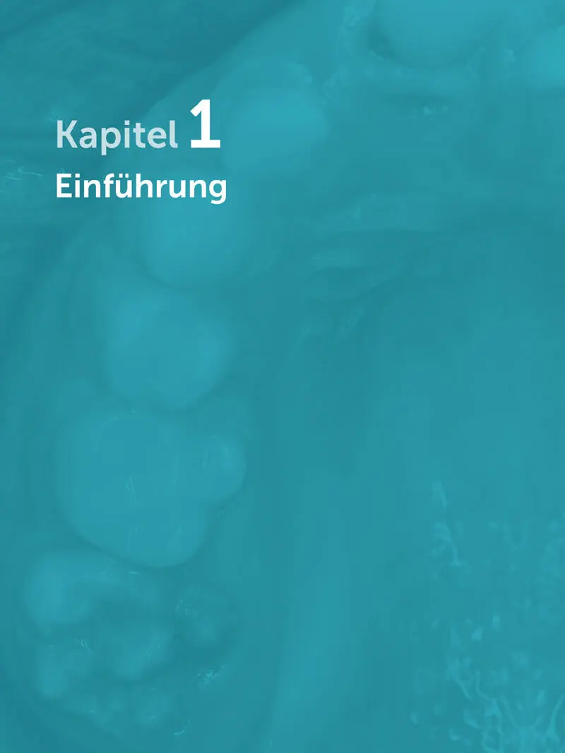 Die MolarenInzisivenHypomineralisation MIH im Volksmund auch Kreidezähne - фото 3