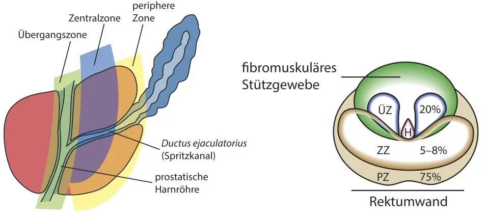 Abb 7 Lokalisierung der Prostatazonen und Nähe zum Rektum ÜZ Übergangszone - фото 7
