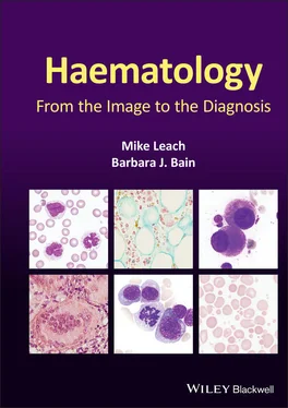 Barbara J. Bain Haematology обложка книги