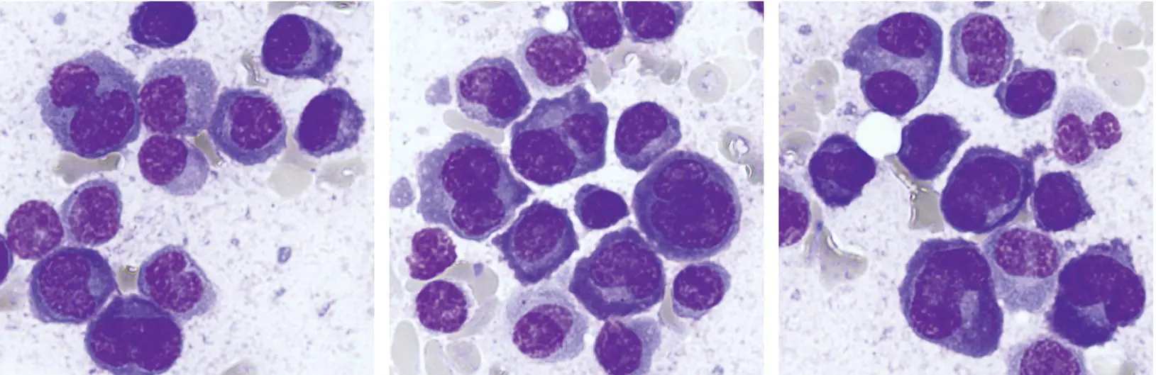 It may be worth reassessing the marrow in patients developing severe cytopenias - фото 29