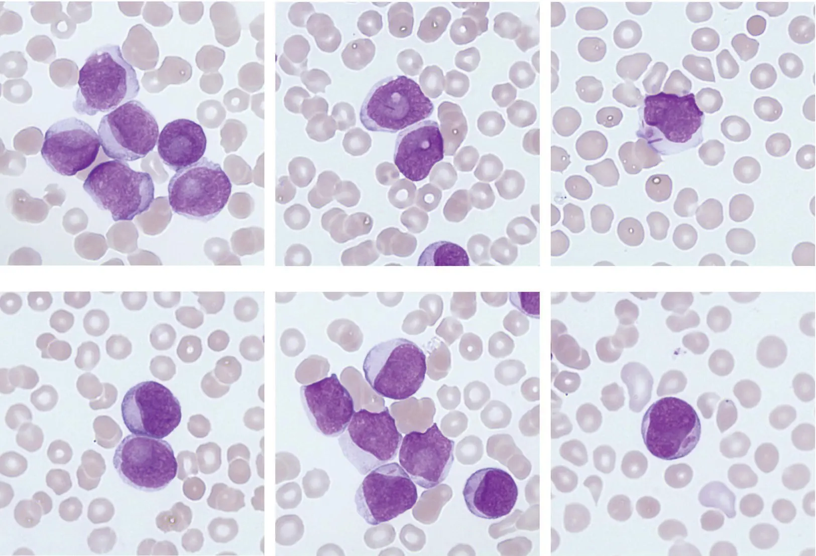 A 54yearold woman attended Accident and Emergency with fever progressive - фото 6