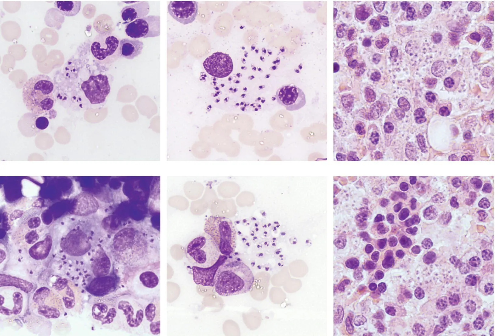 A 5yearold boy was referred for investigation of anorexia abdominal bloating - фото 19