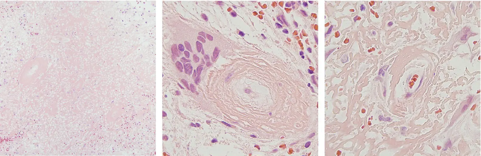 MCQ 1 Amyloid in tissue sections can be identified by positive staining - фото 5