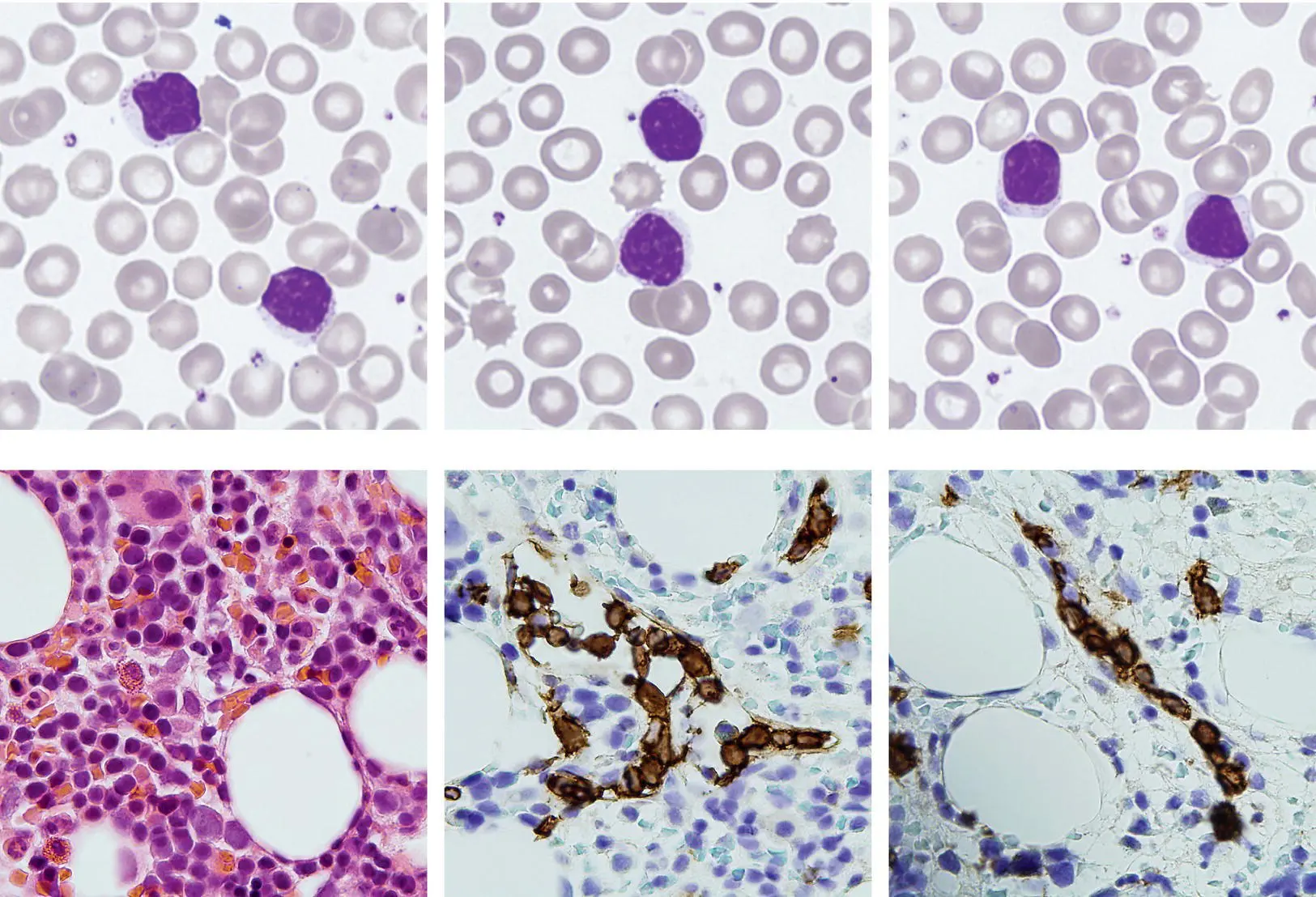 A 53yearold man with rheumatoid arthritis was referred on account of - фото 24