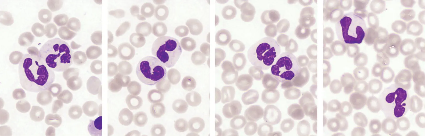 The neutrophil has been a focus of attention for haematologists for many - фото 7