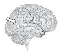 Рис 8 На рисунке показана правая угловая извилина с электродами где - фото 9