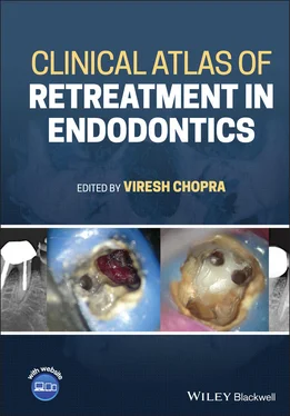 Неизвестный Автор Clinical Atlas of Retreatment in Endodontics обложка книги