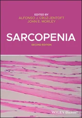 Sarcopenia