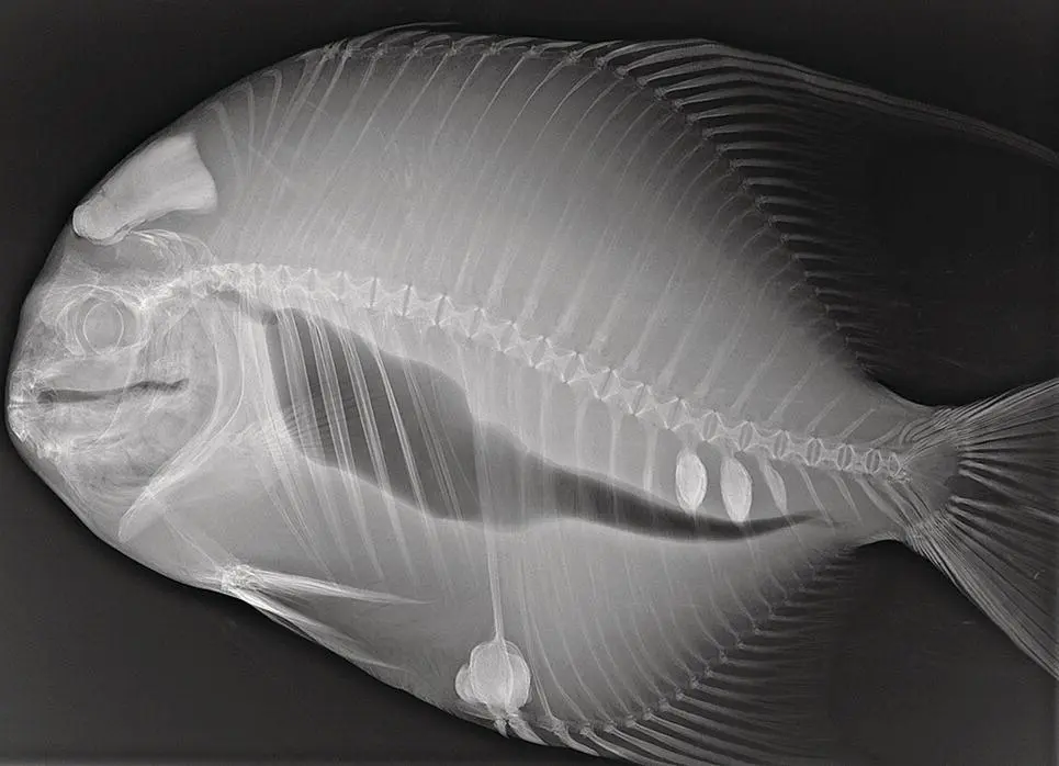 Figure A12 Radiograph of an Atlantic spadefish Chaetodipterus faber - фото 3