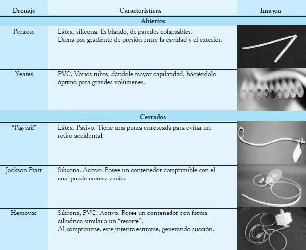 Riesgos de los drenajes Es importante destacar que los drenajes no sustituyen - фото 47