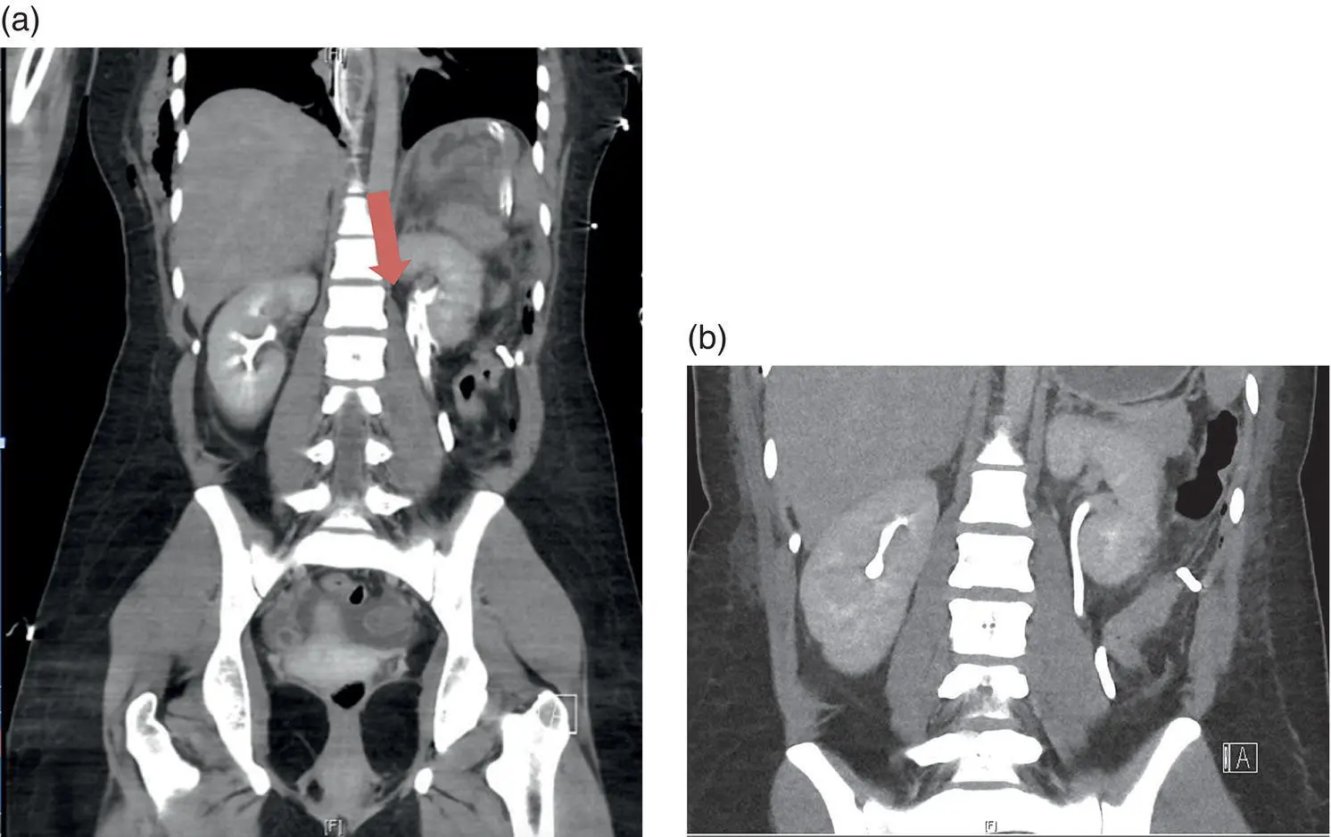 Figure 24 Twentyfiveyearold female who sustained multiple stab wounds with - фото 10