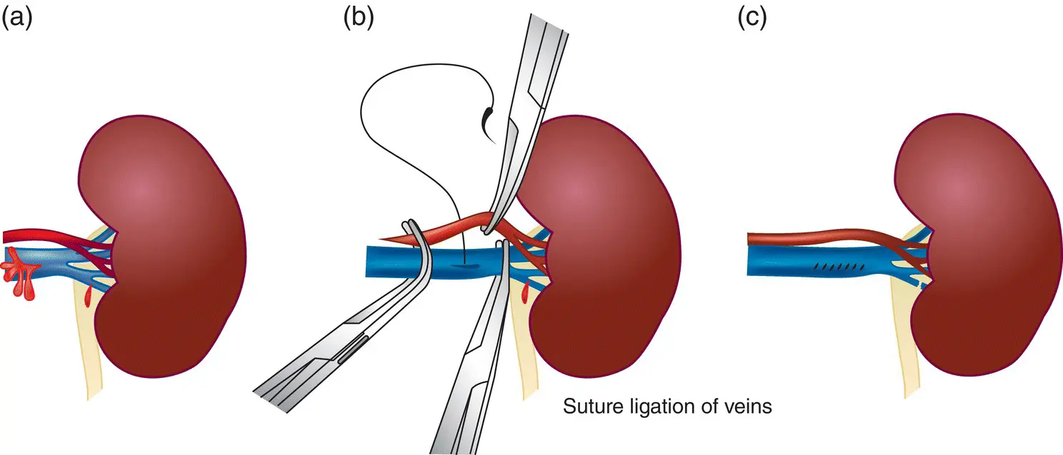 Figure 15 Surgical management of vascular injuries a Schematic showing - фото 6