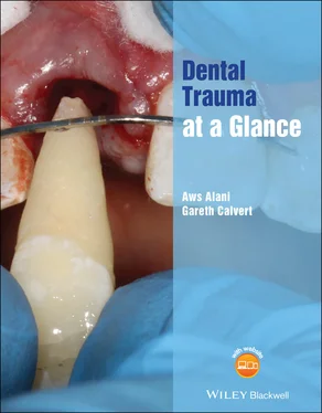 Aws Alani Dental Trauma at a Glance обложка книги