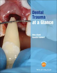 Aws Alani - Dental Trauma at a Glance