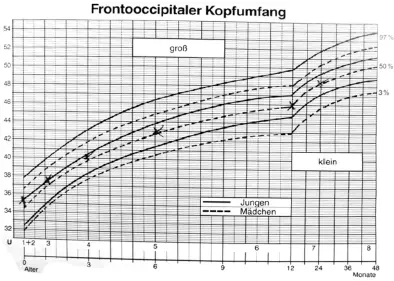 Abb 41 Perzentile für die Entwicklung des Kopfumfangs im KUHeft Falls es in - фото 33