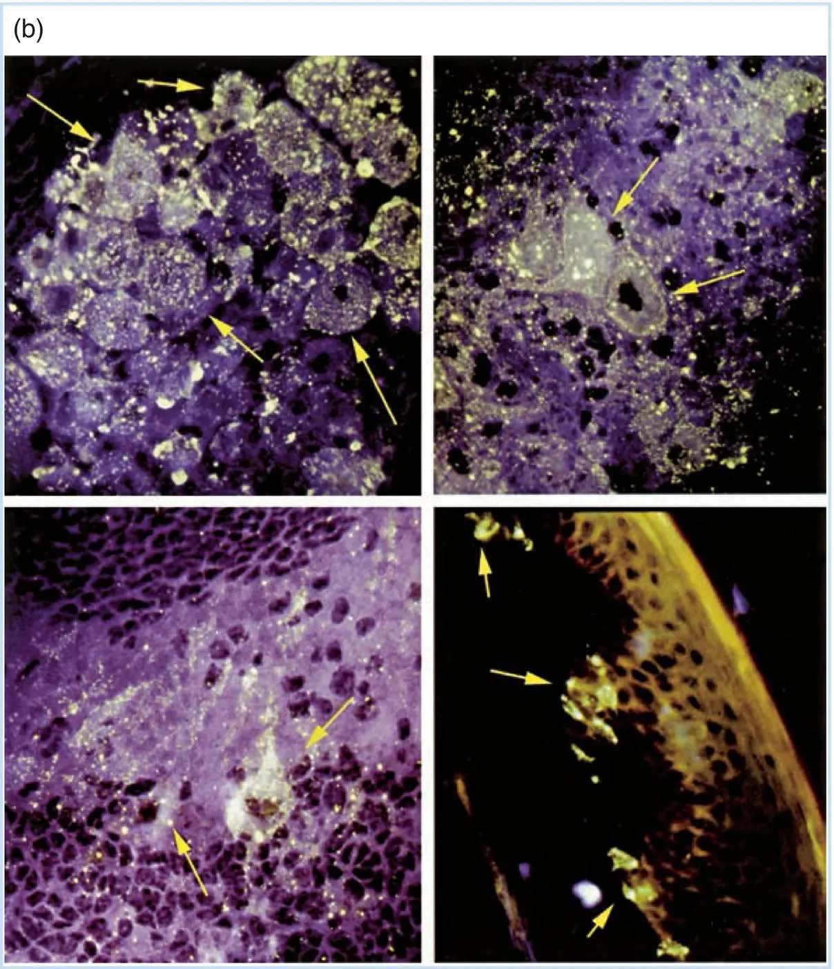 Figure 35Visualization of rabies virusinfected neurons in experimentally - фото 13
