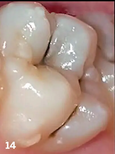 Protocols for Mobile Dental Photography with Auxiliary Lighting - фото 20