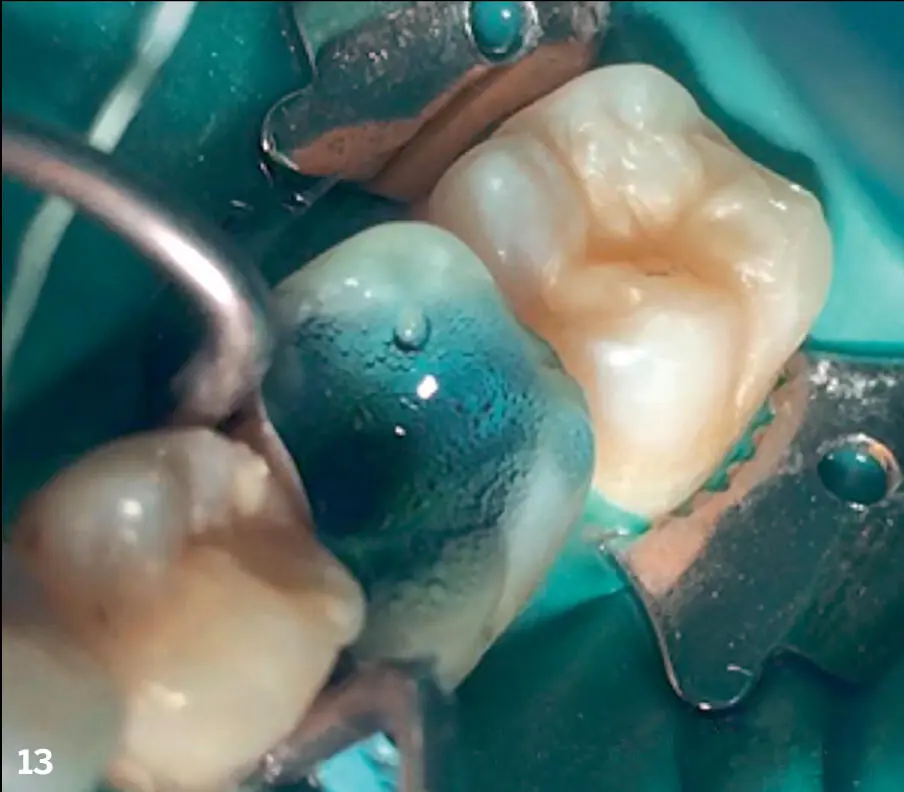 Protocols for Mobile Dental Photography with Auxiliary Lighting - фото 19