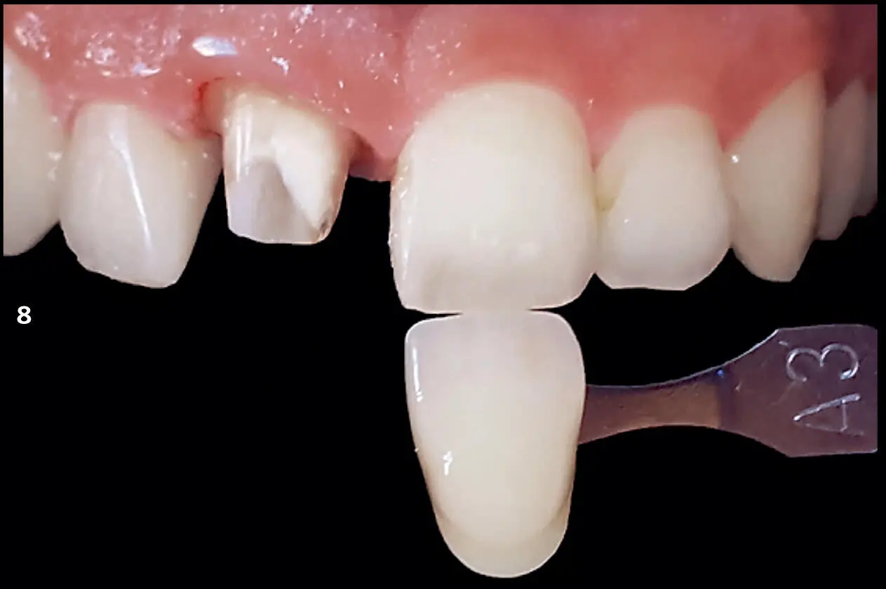 FIGS 79The three photographs that should be sent to the dental technician 1 - фото 14