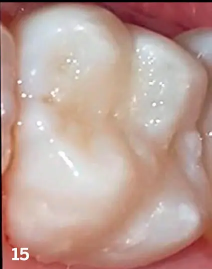 Protocols for Mobile Dental Photography with Auxiliary Lighting - фото 21