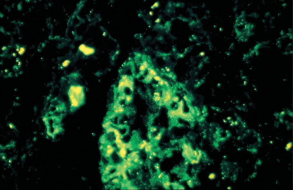 Figure 65 ICA demonstrated by indirect immunofluorescence in a frozen section - фото 57